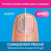 Treatment of Fungal Nail Medical Device Nail Solution