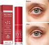 Retinol Eye Stick with Collagen 5PCS,Hyaluronic Acid for Dark Circle, Wrinkles,Visible Results in 3-4 Weeks,Anti Aging Under Eye Cream,  for Puffiness and Bags Reduces Fine Lines