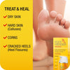 All in One | Treats and Heals Dry Feet, Hard Skin (calluses), Corns and Cracked Heels (Heel fissures) | Significant Effect After First Treatment | 100ml