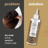 Scalp Treatment Products from  for Dry, Itchy, Flaky Scalp & Hair, Dandruff, Spots & Pimples | Daily Care for People with Eczema or Psoriasis | Hair Cleanser for Men & Women (250ml)